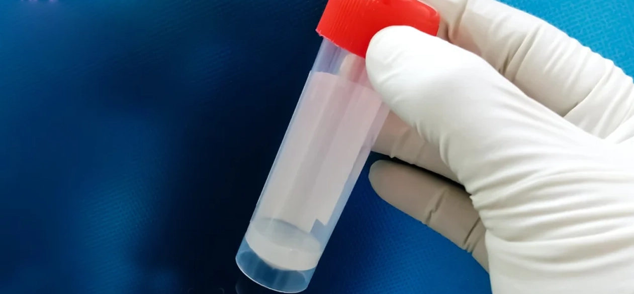 Tekrarlanan Sperm Testleri Neden Gerekebilir?